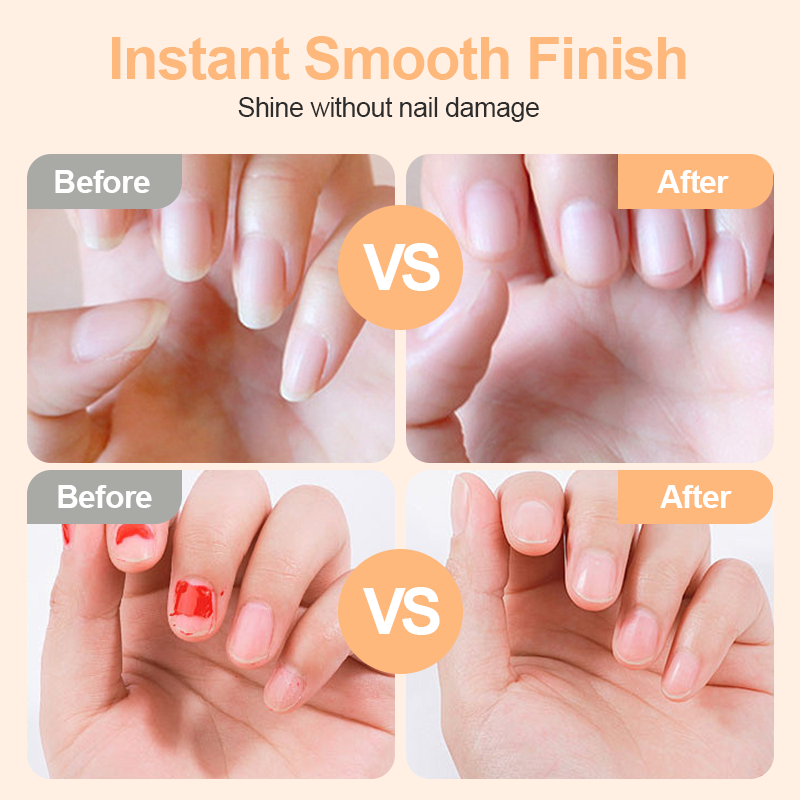 📢📢50% OFF !! ⏰TrimPro™ 2-in-1 Smart Electric Nail Trimmer & Polisher for All Ages 👨‍👩‍👧‍👦 – Blade-Free, Blood-Free & Stress-Free Nail Care! 💅