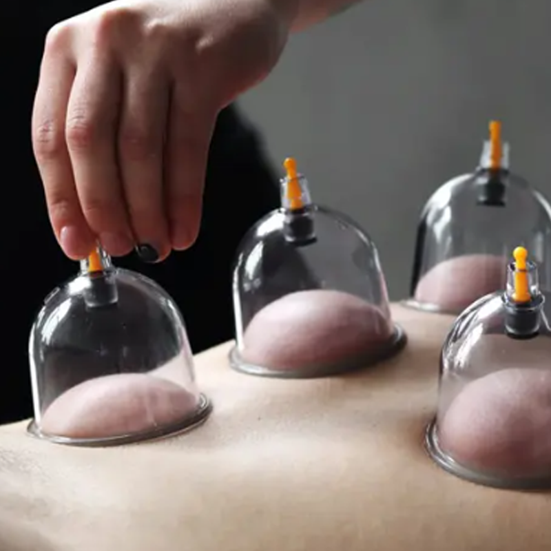 🔥 Hot sale 30% OFF🔥Thickened Vacuum Cupping Set with Suction Pump