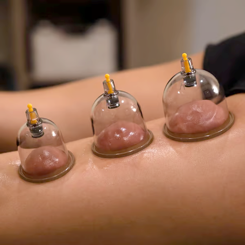 🔥 Hot sale 30% OFF🔥Thickened Vacuum Cupping Set with Suction Pump