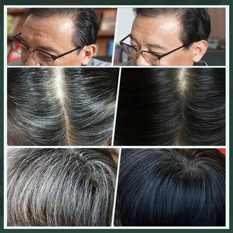 📢📢40% OFF !! ⏰Plant-Based Comb Hair Dye