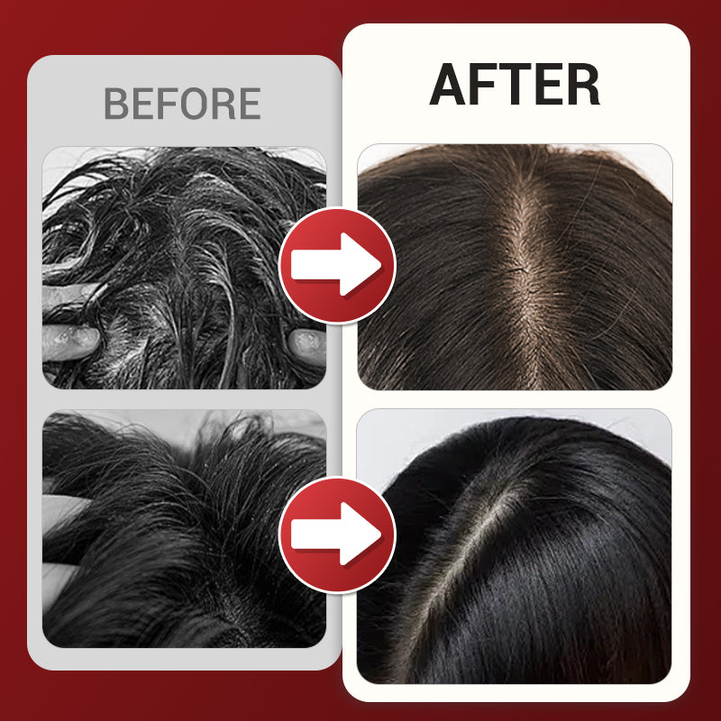 📢📢40% OFF !! ⏰Multi-function Head Massage Comb