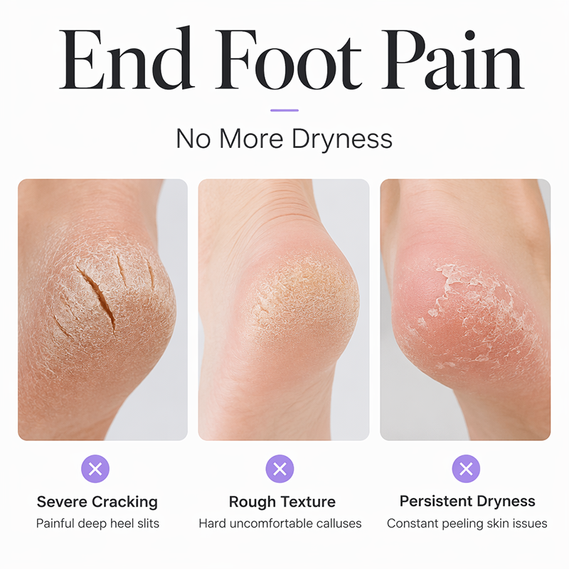 📢📢50% OFF !! ⏰Silicone Moisturizing Socks for Dry Cracked Feet