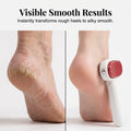📢📢50% OFF !! ⏰Double-Sided Foot Scraper for Callus Removal